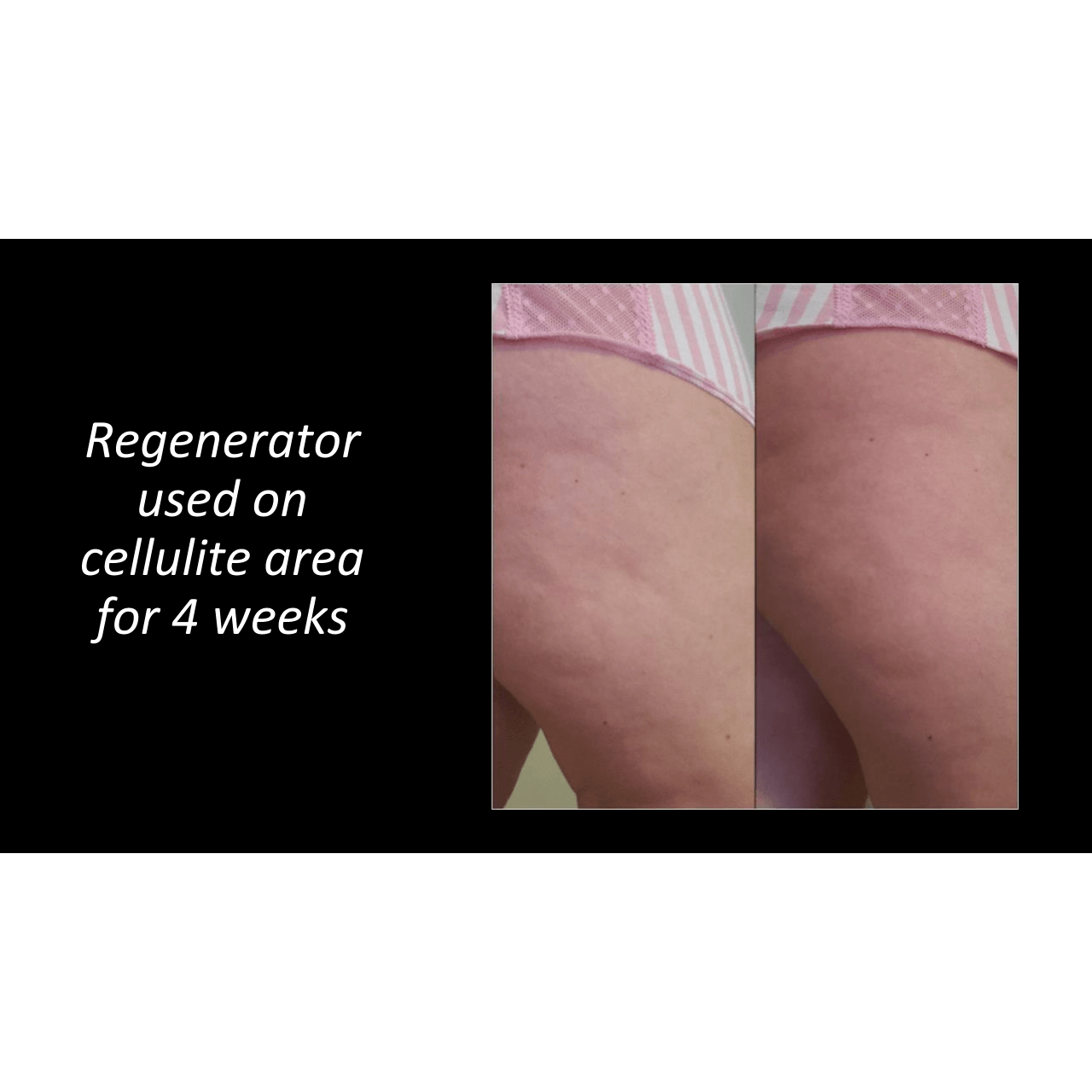 The Regenerator-Apple Cider Vi - Zoo Med Reptile Crest Gecko Food review and price